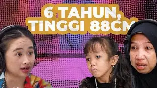 ACHONDROPLASIA : KELAINAN TULANG RAWAN 