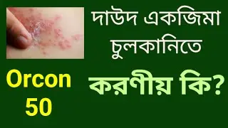 Orcon 50 mg ( Fluconazole ) চর্মরোগ একজিমা চুলকানির ম্যাজিক মেডিসিন।