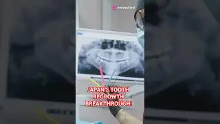 Japan's Tooth Regrowth Breakthrough!