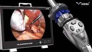 YKD-9122 Full HD Endoscopy Camera System &ndash; Clear Vision for Precise Diagnosis