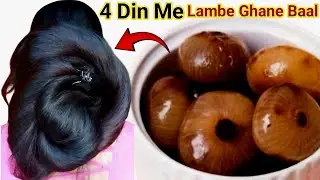 Diy Onion Oil For Hairgrowth 🧅 Hair Fall will Stop 🛑 Hair will Become Long Thick & strong 💪