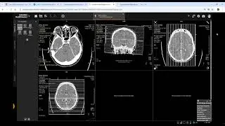 MPR e funcionalidades básicas do Smart Simulator Siemens.