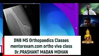 Tumors viva class osce ,master course mentorexam.com Dr.Prashant madan mohan for DNB MS Orthopaedics