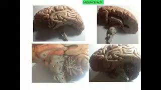 NEUROANATOMIA - LEZIONE 12 DI 20 - TRONCO ENCEFALICO