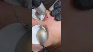 САМЫЙ КРУТОЙ В МИРЕ 🌍 АВТОПАРК ЛАЗЕРНЫХ АППАРАТОВ ДЛЯ БЫСТРОГО УДАЛЕНИЯ 🔫 🤍 Студия Expert PMU