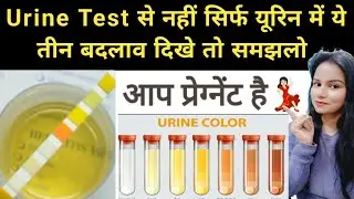 Urine Test Nahi, Sirf Urine Dekh kar hi pta chal jayega Ki Baccha Ruka Hai Yah Nahi #pregnancy