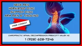 Prescott Valley Chiropractic Spinal Decompression AZ 86314 | Cervical Spinal Decompression AZ 86314