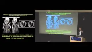 Lewis Cantley: 2014 Breakthrough Prize in Life Sciences Symposium