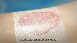 &iquest;C&oacute;mo funciona Biobrane?
