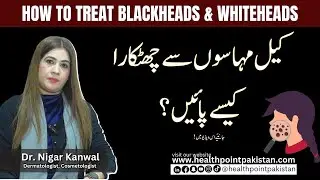 How to Treat Blackheads & Whiteheads Effectively | Skin Care Tips by Dr. Nigar Kanwal