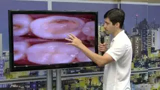 Especialista explica diferença de bloco e coroa