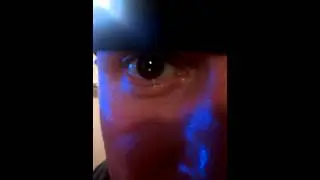 Wireless retina implant  Nano lens with diodes