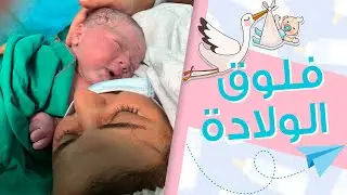 فلوق الولادة ... أجمل وأصعب اللحظات