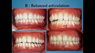 Removable 501 | Lec 3 | Complete denture problems