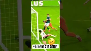 RICARDO PEPI SCOORT maar BREEKT ARM 😳🦴 #baileyfreestyle #psv #voetbal #eredivisie #broer #shorts