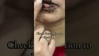 #lipscrubs #lipcare #beauty #lipbalm #vaseline #ytshorts #yt #trending #fyp #fy #ytshorts #trends
