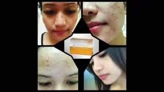 NWORLD NLIGHTEN Kojic Papaya with Glutathione Soap