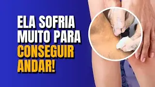 PACIENTE COM INDICA&Ccedil;&Atilde;O CIR&Uacute;RGICA! | Tratamento com agulhamento distal