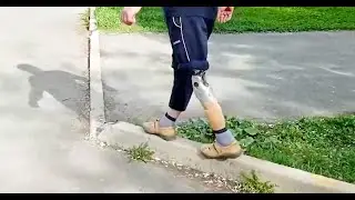 Интеллектуальное микропроцессорное колено “Intuy Knee”