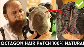 OCTAGON HAIR PATCHES IN PAKISTAN: HOW TO INSTALL AND GET 100% NATURAL LOOK | NEW HAIR IMAGE