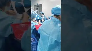 Hydrogel Facial Mask Making Machine #shorts #short #shortvideo #shortsyoutube #cosmetics #skincare