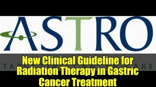 New Clinical Guideline for Radiation Therapy in Gastric Cancer Treatment
