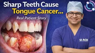 Sharp Teeth Can Cause Tongue Cancer | Real Patient Story | Tongue Cancer Surgery| Dr Saurabh Jain 