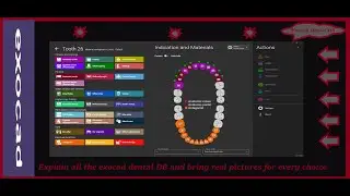 How to use exocad dental db and reveal all secrets, bring pictures for every choice/ exocad tutorial