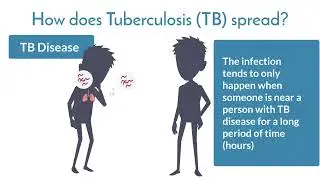 Understanding Tuberculosis: Transmission (video 3 of 5)