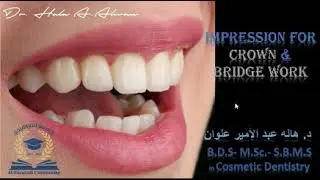 9b  impressoin for crown and bridge work part1