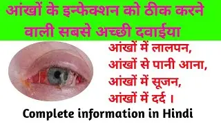 आंखों मे इन्फेक्शन का इलाज। Eye infection treatment medicine।Eye flu treatment in hindi।