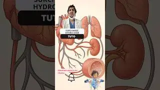 Comprendre & pr&eacute;venir la surcharge hydro-sod&eacute;e #infirmier #nurse #tutorial #guide #ide #care #nurse