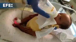 Dada de alta una bebé que nació con 450 gramos a menos de 23 semanas de gestación