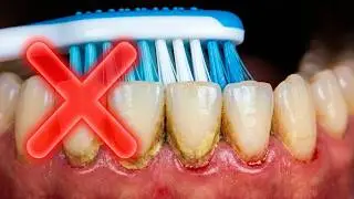 Tartar & Plaque: Why Professional Dental Cleaning Matters (Especially After 40)