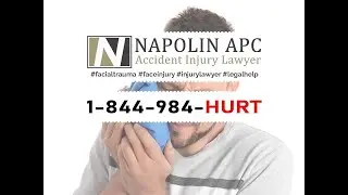 Facial Trauma Injury Lawyer | Types Of Facial Trauma And Legal Remedies | Los Angeles County