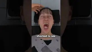 A Snake Crawled Into Her Mouth While Sleeping 😱