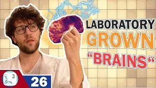 Scientists Grow Mini Brains in the Laboratory! | Brain organoids