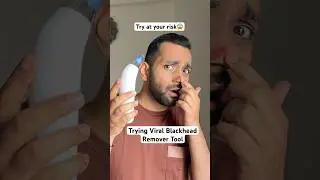 Trying viral blackhead remover tool 😱 #blackheads #skincare #amazonfinds #ytshorts #shortsindia