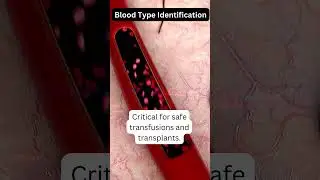 Blood Type Identification