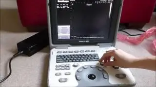 Basic controls on the SonoScape A5