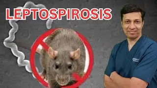 Leptospirosis lecture in hindi. Leptospirosis treatment. Weils disease in hindi.