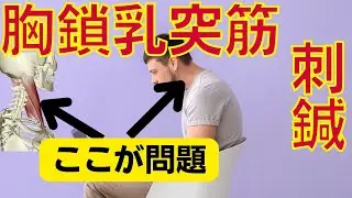 胸鎖乳突筋への摘み押手の刺鍼｜上位交差性症候群などに