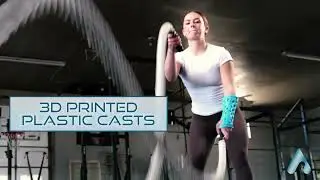 How to Work Out with a Broken Bone: ActivArmor is The Best Waterproof Cast for Athletes