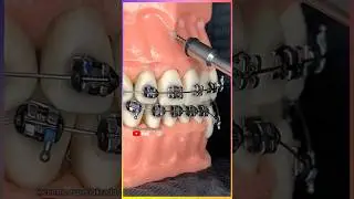 The SCARIEST Dentist Device You Will Ever See! 😳🦷