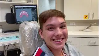 Amazing Invisalign Results by Dr. Susan Ellison | Houston, Texas