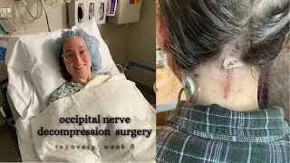 occipital nerve decompression surgery: 8 week update