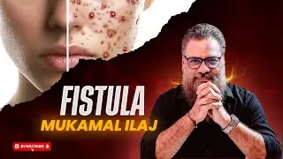 Fistula (Naasoor) Ka Mukammal Ilaj? BEB Medicine Se Jarr Se Behtari &ndash; Dr Ibrahim