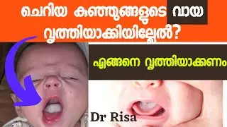 How to Clean Baby Tongue and Gums | Infant Oral Care Malayalam