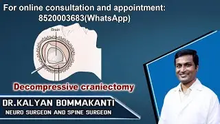 Decompressive craniectomy part 2: training best neurosurgeons