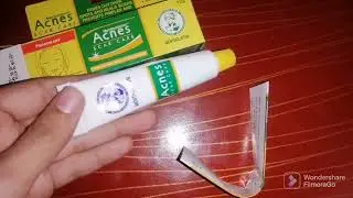 review on acnes scar care || best cream for dark spots